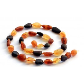 Raw Amber Necklace 